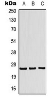 TSN / Translin Antibody - Western blot analysis of Translin expression in MCF7 (A); HeLa (B); HepG2 (C) whole cell lysates.