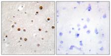 TSN / Translin Antibody - Peptide - + Immunohistochemistry analysis of paraffin-embedded human brain tissue using TSN antibody.