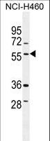 TSNARE1 Antibody - TSNARE1 Antibody western blot of NCI-H460 cell line lysates (35 ug/lane). The TSNARE1 antibody detected the TSNARE1 protein (arrow).