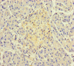 TSNARE1 Antibody - Immunohistochemistry of paraffin-embedded human pancreatic tissue at dilution of 1:100