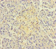 TSNARE1 Antibody - Immunohistochemistry of paraffin-embedded human pancreatic tissue at dilution of 1:100