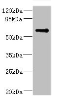 TSNARE1 Antibody - Western blot All Lanes: TSNARE1 antibody IgG at 16ug/ml+ Mouse lung tissue Secondary Goat polyclonal to rabbit IgG at 1/10000 dilution Predicted band size: 56 kDa Observed band size: 56 kDa
