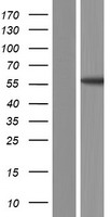 TSNARE1 Protein - Western validation with an anti-DDK antibody * L: Control HEK293 lysate R: Over-expression lysate