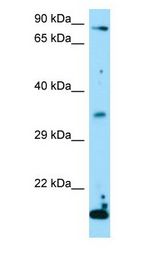 TSNAX / TRAX Antibody - TSNAX / TRAX antibody Western Blot of 293T.  This image was taken for the unconjugated form of this product. Other forms have not been tested.