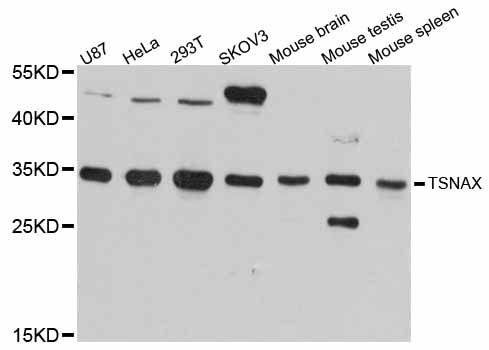 TSNAX / TRAX Antibody - Western blot analysis of extracts of various cell lines, using TSNAX antibody at 1:3000 dilution. The secondary antibody used was an HRP Goat Anti-Rabbit IgG (H+L) at 1:10000 dilution. Lysates were loaded 25ug per lane and 3% nonfat dry milk in TBST was used for blocking. An ECL Kit was used for detection and the exposure time was 1s.
