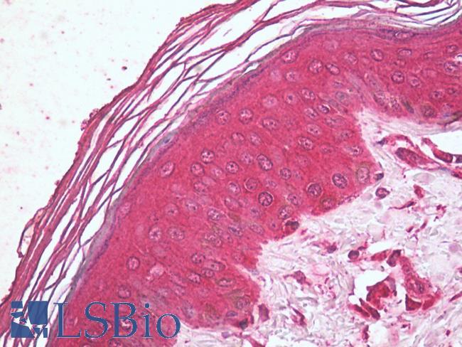 TSP23 Antibody - Human Skin: Formalin-Fixed, Paraffin-Embedded (FFPE).  This image was taken for the unconjugated form of this product. Other forms have not been tested.