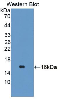 TSPAN1 / TM4SF Antibody - Western blot of TSPAN1 / TM4SF antibody.