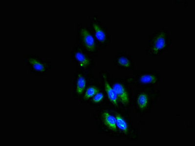 TSPAN1 / TM4SF Antibody - Immunofluorescent analysis of Hela cells using TSPAN1 Antibody at dilution of 1:100 and Alexa Fluor 488-congugated AffiniPure Goat Anti-Rabbit IgG(H+L)