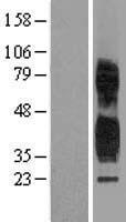 TSPAN1 / TM4SF Protein - Western validation with an anti-DDK antibody * L: Control HEK293 lysate R: Over-expression lysate