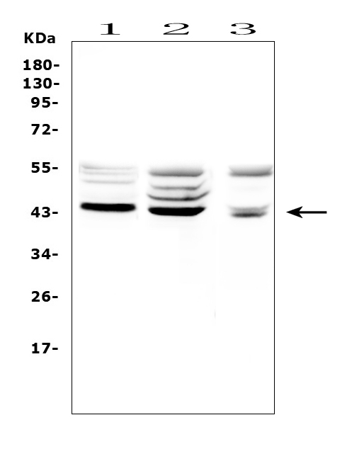 TSPAN12 Antibody - Western blot analysis of TSPAN12 using anti-TSPAN12 antibody. Electrophoresis was performed on a 5-20% SDS-PAGE gel at 70V (Stacking gel) / 90V (Resolving gel) for 2-3 hours. The sample well of each lane was loaded with 50ug of sample under reducing conditions. Lane 1: rat kidney tissue lysates, Lane 2: rat brain tissue lysates, Lane 3: mouse brain tissue lysates. After Electrophoresis, proteins were transferred to a Nitrocellulose membrane at 150mA for 50-90 minutes. Blocked the membrane with 5% Non-fat Milk/ TBS for 1.5 hour at RT. The membrane was incubated with rabbit anti-TSPAN12 antigen affinity purified polyclonal antibody at 0.5 µg/mL overnight at 4°C, then washed with TBS-0.1% Tween 3 times with 5 minutes each and probed with a goat anti-rabbit IgG-HRP secondary antibody at a dilution of 1:10000 for 1.5 hour at RT. The signal is developed using an Enhanced Chemiluminescent detection (ECL) kit with Tanon 5200 system. A specific band was detected for TSPAN12 at approximately 43KD. The expected band size for TSPAN12 is at 35KD.