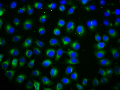 TSPAN12 Antibody - Immunofluorescence staining of A549 cells diluted at 1:133, counter-stained with DAPI. The cells were fixed in 4% formaldehyde, permeabilized using 0.2% Triton X-100 and blocked in 10% normal Goat Serum. The cells were then incubated with the antibody overnight at 4°C.The Secondary antibody was Alexa Fluor 488-congugated AffiniPure Goat Anti-Rabbit IgG (H+L).
