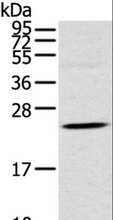 TSPAN13 / TM4SF13 Antibody - Western blot analysis of Human fetal brain tissue, using TSPAN13 Polyclonal Antibody at dilution of 1:550.