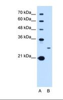 TSPAN15 Antibody - Lane A: Marker. Lane B: HepG2 cell lysate. Antibody concentration: 1.0 ug/ml. Gel concentration: 12%.  This image was taken for the unconjugated form of this product. Other forms have not been tested.