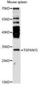 TSPAN15 Antibody - Western blot analysis of extracts of mouse spleen, using TSPAN15 antibody at 1:3000 dilution. The secondary antibody used was an HRP Goat Anti-Rabbit IgG (H+L) at 1:10000 dilution. Lysates were loaded 25ug per lane and 3% nonfat dry milk in TBST was used for blocking. An ECL Kit was used for detection and the exposure time was 90s.