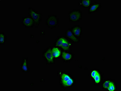TSPAN16 Antibody - Immunofluorescent analysis of MCF-7 cells using TSPAN16 Antibody at dilution of 1:100 and Alexa Fluor 488-congugated AffiniPure Goat Anti-Rabbit IgG(H+L)
