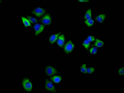 TSPAN18 / TSPAN Antibody - Immunofluorescence staining of Hela cells diluted at 1:100, counter-stained with DAPI. The cells were fixed in 4% formaldehyde, permeabilized using 0.2% Triton X-100 and blocked in 10% normal Goat Serum. The cells were then incubated with the antibody overnight at 4°C.The Secondary antibody was Alexa Fluor 488-congugated AffiniPure Goat Anti-Rabbit IgG (H+L).