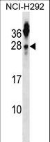 TSPAN2 Antibody - TSPAN2 Antibody western blot of NCI-H292 cell line lysates (35 ug/lane). The TSPAN2 antibody detected the TSPAN2 protein (arrow).