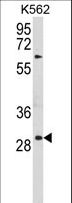 TSPAN20 / UPK1B Antibody - Western blot of UPK1B Antibody in K562 cell line lysates (35 ug/lane). UPK1B (arrow) was detected using the purified antibody.