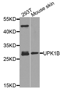 TSPAN20 / UPK1B Antibody - Western blot analysis of extract of various cells.