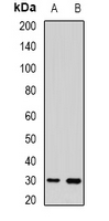 TSPAN20 / UPK1B Antibody - Western blot analysis of UPIb expression in HEK293T (A); mouse skin (B) whole cell lysates.