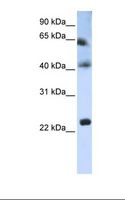 TSPAN3 Antibody - Hela cell lysate. Antibody concentration: 1.0 ug/ml. Gel concentration: 12%.  This image was taken for the unconjugated form of this product. Other forms have not been tested.