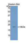 TSPAN3 Antibody - Western blot of recombinant TSPAN3.  This image was taken for the unconjugated form of this product. Other forms have not been tested.