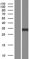 TSPAN3 Protein - Western validation with an anti-DDK antibody * L: Control HEK293 lysate R: Over-expression lysate