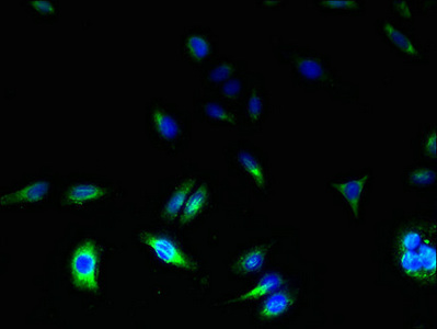 TSPAN31 Antibody - Immunofluorescent analysis of HepG2 cells using TSPAN31 Antibody at dilution of 1:100 and Alexa Fluor 488-congugated AffiniPure Goat Anti-Rabbit IgG(H+L)