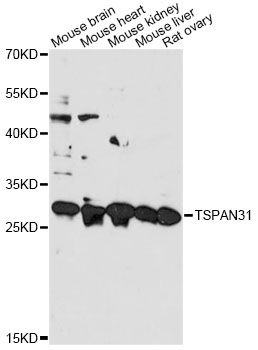 TSPAN31 Antibody - Western blot analysis of extracts of various cell lines, using TSPAN31 antibody at 1:3000 dilution. The secondary antibody used was an HRP Goat Anti-Rabbit IgG (H+L) at 1:10000 dilution. Lysates were loaded 25ug per lane and 3% nonfat dry milk in TBST was used for blocking. An ECL Kit was used for detection and the exposure time was 60s.