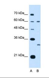 TSPAN32 / PHEMX Antibody - Lane A: Marker. Lane B: Jurkat cell lysate. Antibody concentration: 5.0 ug/ml. Gel concentration: 12%.  This image was taken for the unconjugated form of this product. Other forms have not been tested.