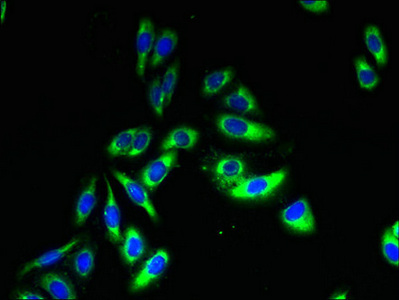 TSPAN33 / PEN Antibody - Immunofluorescent analysis of HepG2 cells using TSPAN33 Antibody at dilution of 1:100 and Alexa Fluor 488-congugated AffiniPure Goat Anti-Rabbit IgG(H+L)
