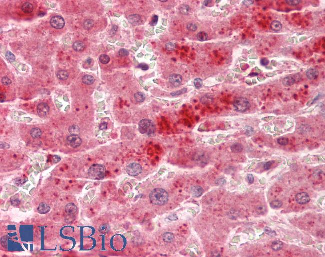 TSPAN4 Antibody - Human Liver: Formalin-Fixed, Paraffin-Embedded (FFPE).  This image was taken for the unconjugated form of this product. Other forms have not been tested.