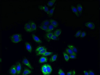 TSPAN7 / CD231 Antibody - Immunofluorescent analysis of HepG2 cells using TSPAN7 Antibody at dilution of 1:100 and Alexa Fluor 488-congugated AffiniPure Goat Anti-Rabbit IgG(H+L)