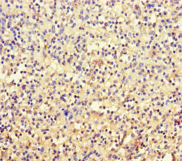 TSPAN7 / CD231 Antibody - Immunohistochemistry of paraffin-embedded human spleen tissue using TSPAN7 Antibody at dilution of 1:100