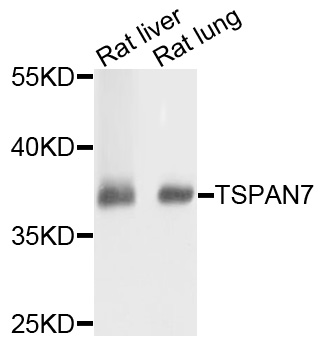 TSPAN7 / CD231 Antibody - Western blot analysis of extracts of various cells.