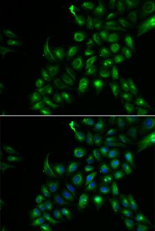 TSPAN7 / CD231 Antibody - Immunofluorescence analysis of U2OS cells.