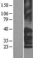 TSPAN7 / CD231 Protein - Western validation with an anti-DDK antibody * L: Control HEK293 lysate R: Over-expression lysate