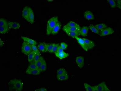 TSPAN9 Antibody - Immunofluorescence staining of HepG2 cells at a dilution of 1:233, counter-stained with DAPI. The cells were fixed in 4% formaldehyde, permeabilized using 0.2% Triton X-100 and blocked in 10% normal Goat Serum. The cells were then incubated with the antibody overnight at 4 °C.The secondary antibody was Alexa Fluor 488-congugated AffiniPure Goat Anti-Rabbit IgG (H+L) .