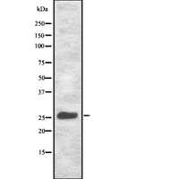 TSPAN9 Antibody - Western blot analysis NET-5 using HeLa whole cells lysates
