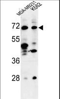 TSPEAR Antibody - Western blot of C21orf29 Antibody in MDA-MB231, K562 cell line lysates (35 ug/lane). C21orf29 (arrow) was detected using the purified antibody.