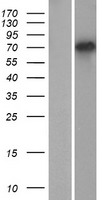 TSPEAR Protein - Western validation with an anti-DDK antibody * L: Control HEK293 lysate R: Over-expression lysate