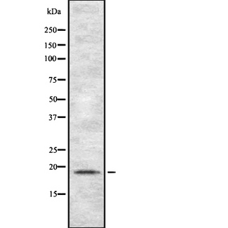 TSPO / PBR Antibody - Western blot analysis of TSPO using Jurkat whole cells lysates