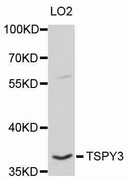 TSPY1 / TSPY Antibody - Western blot analysis of extracts of LO2 cells.