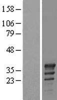 TSPY2 Protein - Western validation with an anti-DDK antibody * L: Control HEK293 lysate R: Over-expression lysate