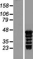 TSPY3 Protein - Western validation with an anti-DDK antibody * L: Control HEK293 lysate R: Over-expression lysate