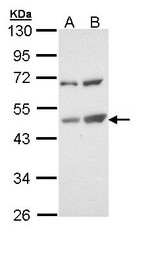TSPYL1 Antibody - Sample (30 ug of whole cell lysate). A: Molt-4 , B: Raji. 10% SDS PAGE. TSPYL1 antibody diluted at 1:1000.