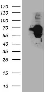 TSPYL1 Antibody - HEK293T cells were transfected with the pCMV6-ENTRY control. (Left lane) or pCMV6-ENTRY TSPYL1. (Right lane) cDNA for 48 hrs and lysed. Equivalent amounts of cell lysates. (5 ug per lane) were separated by SDS-PAGE and immunoblotted with anti-TSPYL1. (1:2000)