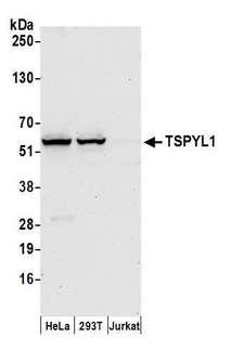 TSPYL1 Antibody - Detection of human TSPYL1 by western blot. Samples: Whole cell lysate (50 µg) from HeLa, HEK293T, and Jurkat cells prepared using NETN lysis buffer. Antibody: Affinity purified rabbit anti-TSPYL1 antibody used for WB at 0.1 µg/ml. Detection: Chemiluminescence with an exposure time of 30 seconds.