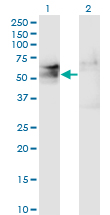 TSPYL1 Antibody - Western Blot analysis of TSPYL1 expression in transfected 293T cell line by TSPYL1 monoclonal antibody (M01), clone 4F11.Lane 1: TSPYL1 transfected lysate (Predicted MW: 49.3 KDa).Lane 2: Non-transfected lysate.