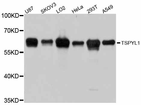 TSPYL1 Antibody - Western blot analysis of extracts of various cell lines, using TSPYL1 antibody at 1:3000 dilution. The secondary antibody used was an HRP Goat Anti-Rabbit IgG (H+L) at 1:10000 dilution. Lysates were loaded 25ug per lane and 3% nonfat dry milk in TBST was used for blocking. An ECL Kit was used for detection and the exposure time was 3s.